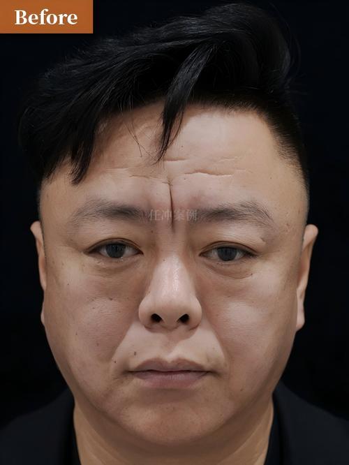祥和24小时在线套医保微信能用吗怎么弄？官方解答来了